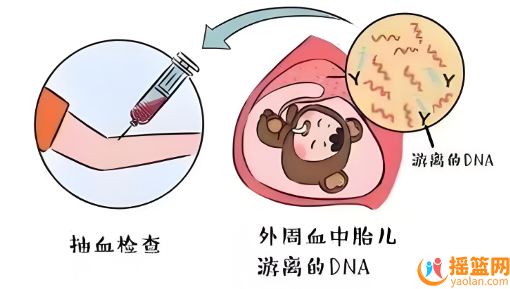 孕五个月羊水泄露症状解析